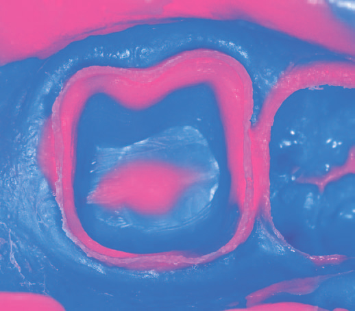 Гидрорайз Лайт Боди - оттиск